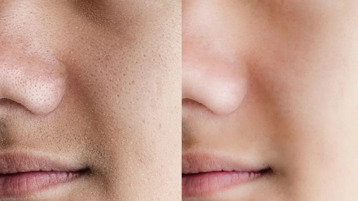 Dry Skin After Moisturizer? 5 Internal Causes You Need to Know