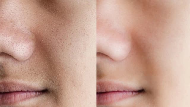 Dry Skin After Moisturizer? 5 Internal Causes You Need to Know